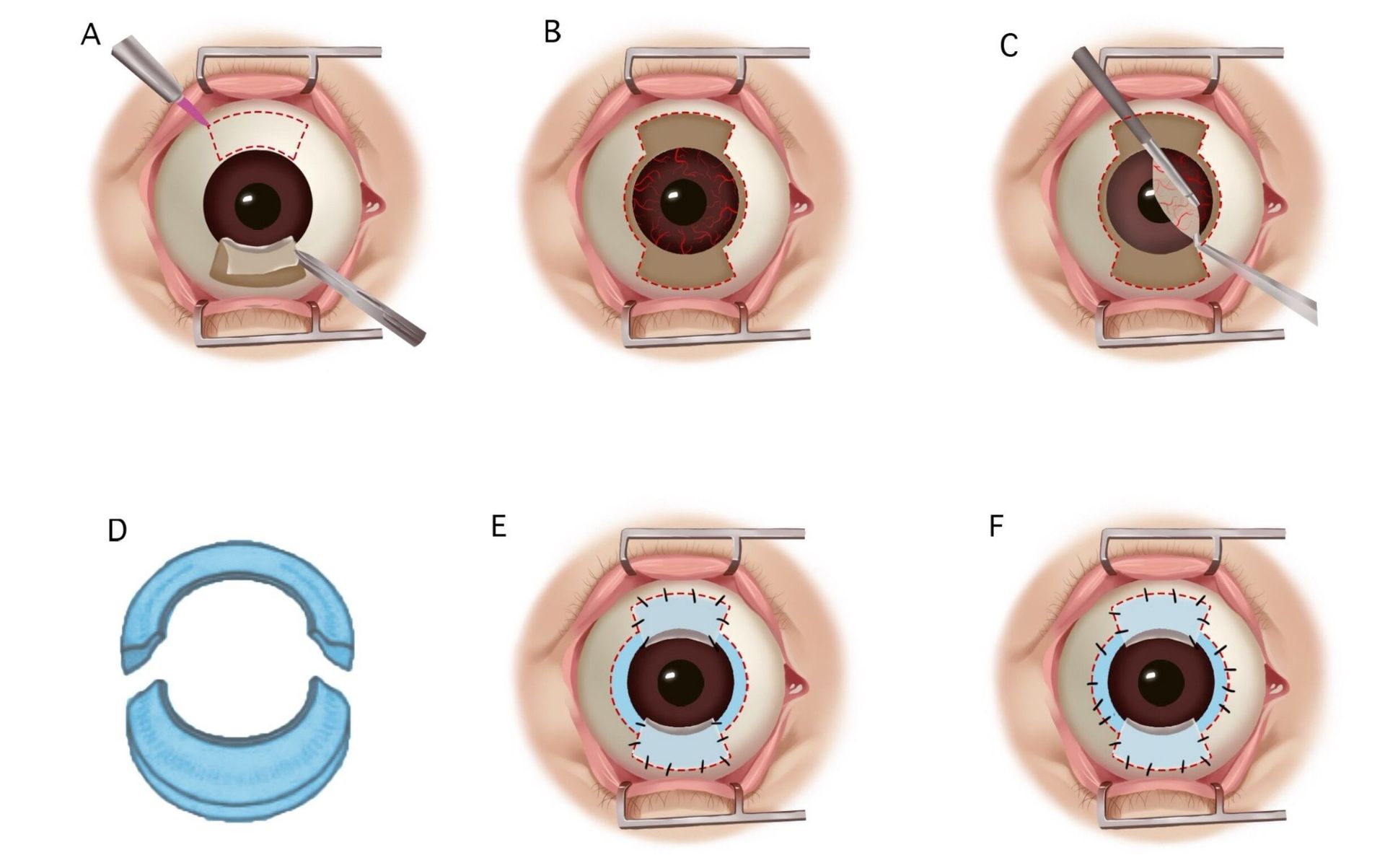 Final clinical illustration